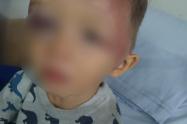Niño agredido en Itagüí, Antioquia