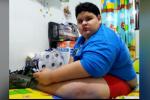 Niño de 12 años pesa 132 kilos en Bello, Antioquia