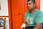 “Siento miedo al dormirme”: Wilfredo, otro afectado que se salvó de milagro en Montebello